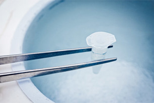 Social Freezing image