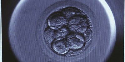 IVF-behandling med donerade spermier image