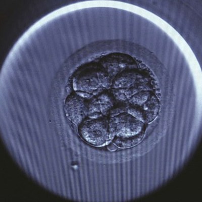 In Vitro Fertilisation (IVF) with donor sperm image