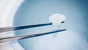 Viktig information för dig som ska frysa könsceller i fertilitetsbevarande syfte.