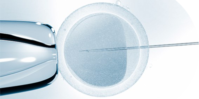 IVF using a sperm donor image