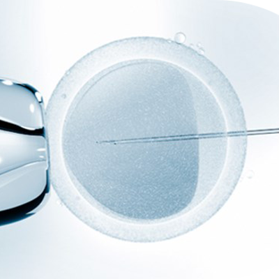 IVF using a sperm donor image