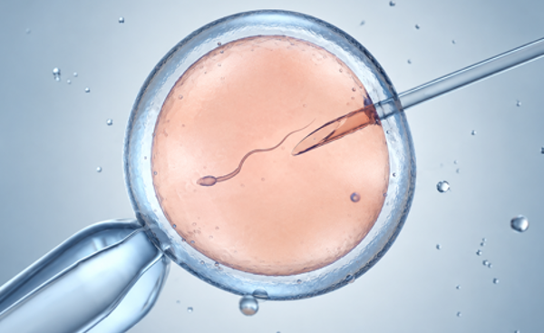 IVF – provrörsbefruktning